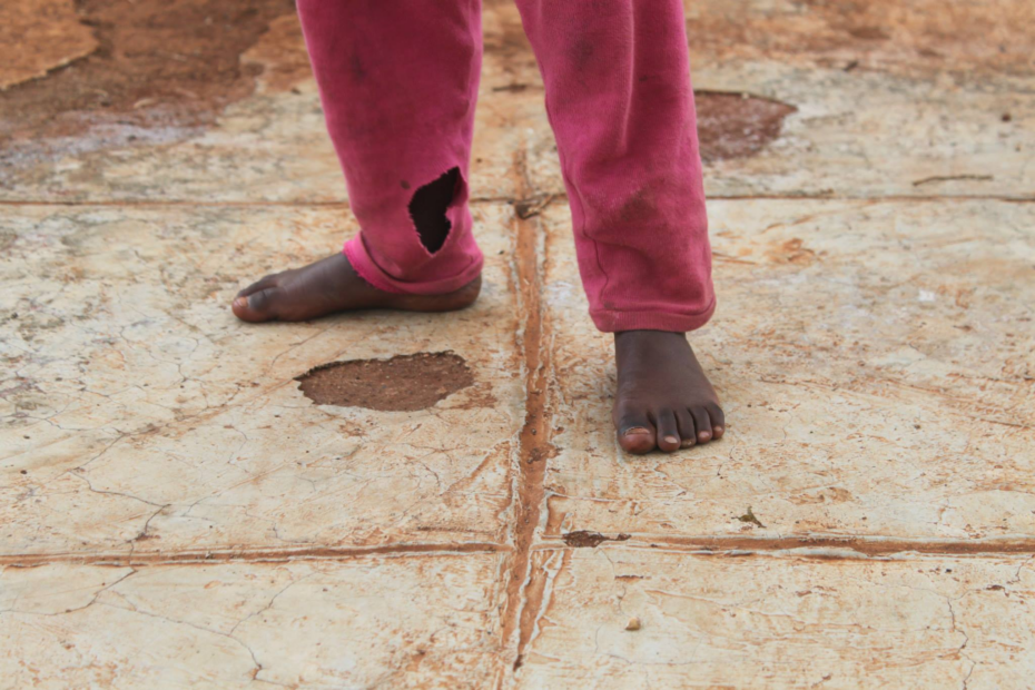 Feet of an orphaned African child representing ethical international volunteering